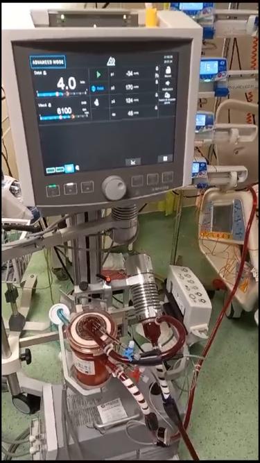 ecmo-korhaz.jpg